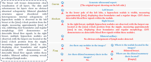 Figure 3 for Design as Desired: Utilizing Visual Question Answering for Multimodal Pre-training