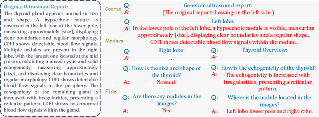 Figure 1 for Design as Desired: Utilizing Visual Question Answering for Multimodal Pre-training