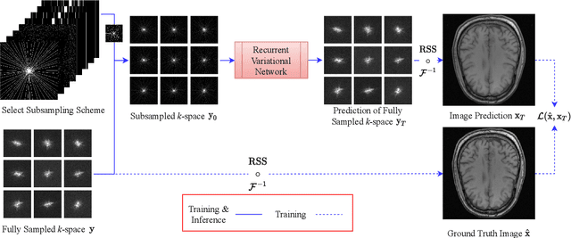 Figure 4 for On Retrospective k-space Subsampling schemes For Deep MRI Reconstruction