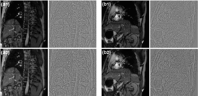 Figure 1 for A No-Reference Medical Image Quality Assessment Method Based on Automated Distortion Recognition Technology: Application to Preprocessing in MRI-guided Radiotherapy