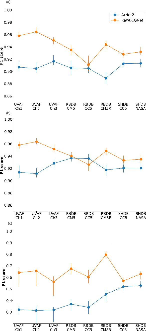 Figure 2 for RawECGNet: Deep Learning Generalization for Atrial Fibrillation Detection from the Raw ECG