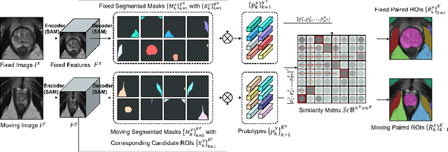 Figure 3 for One registration is worth two segmentations