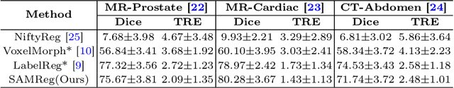 Figure 2 for One registration is worth two segmentations