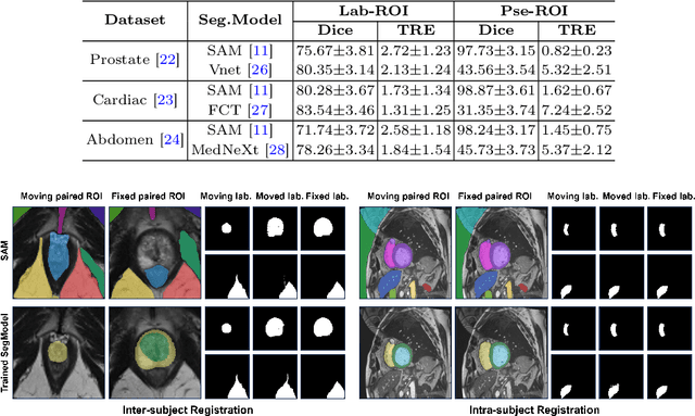 Figure 4 for One registration is worth two segmentations