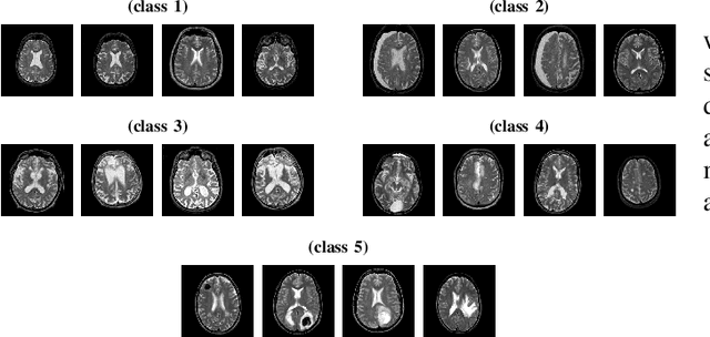 Figure 3 for Backward-Forward Algorithm: An Improvement towards Extreme Learning Machine