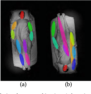 Figure 4 for In-Bed Pose Estimation: Deep Learning with Shallow Dataset