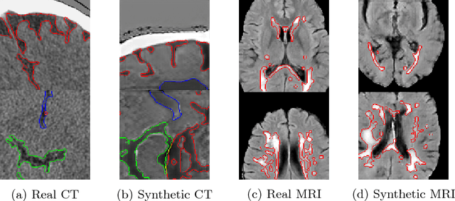 Figure 2 for GAN Augmentation: Augmenting Training Data using Generative Adversarial Networks