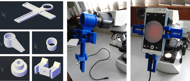 Figure 1 for Deep Convolutional Neural Networks for Microscopy-Based Point of Care Diagnostics