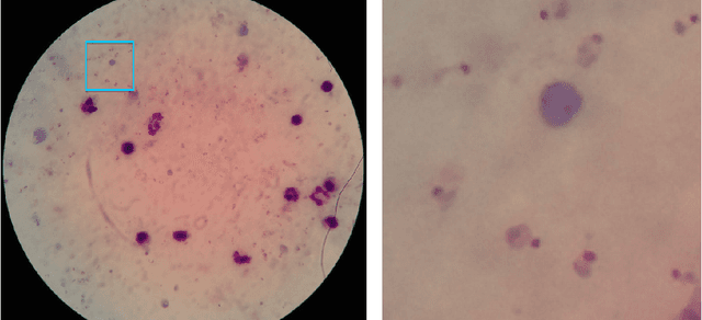 Figure 2 for Deep Convolutional Neural Networks for Microscopy-Based Point of Care Diagnostics