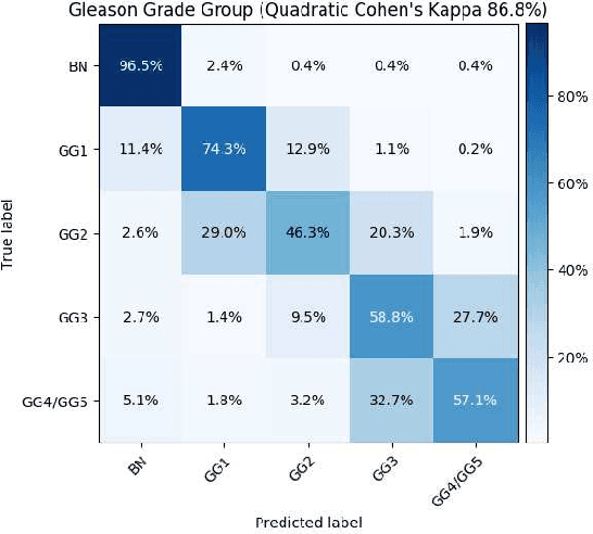 Figure 3 for A Multi-resolution Model for Histopathology Image Classification and Localization with Multiple Instance Learning