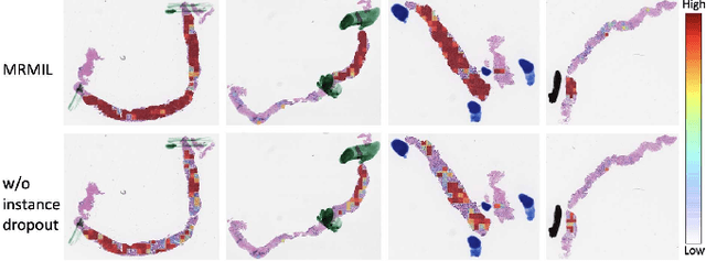 Figure 4 for A Multi-resolution Model for Histopathology Image Classification and Localization with Multiple Instance Learning