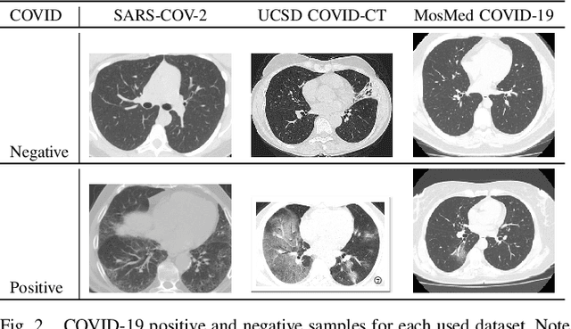 Figure 2 for PrepNet: A Convolutional Auto-Encoder to Homogenize CT Scans for Cross-Dataset Medical Image Analysis