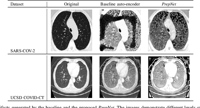 Figure 3 for PrepNet: A Convolutional Auto-Encoder to Homogenize CT Scans for Cross-Dataset Medical Image Analysis