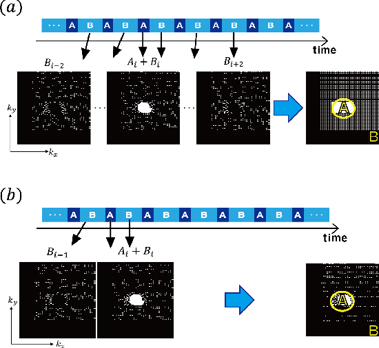 Figure 2 for k-Space Deep Learning for Parallel MRI: Application to Time-Resolved MR Angiography