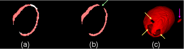 Figure 1 for PC-U Net: Learning to Jointly Reconstruct and Segment the Cardiac Walls in 3D from CT Data