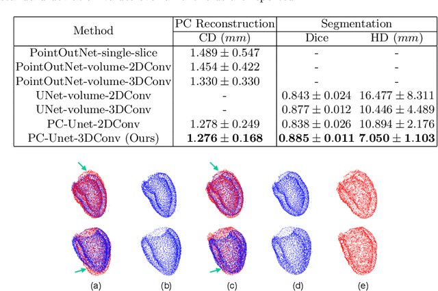 Figure 2 for PC-U Net: Learning to Jointly Reconstruct and Segment the Cardiac Walls in 3D from CT Data