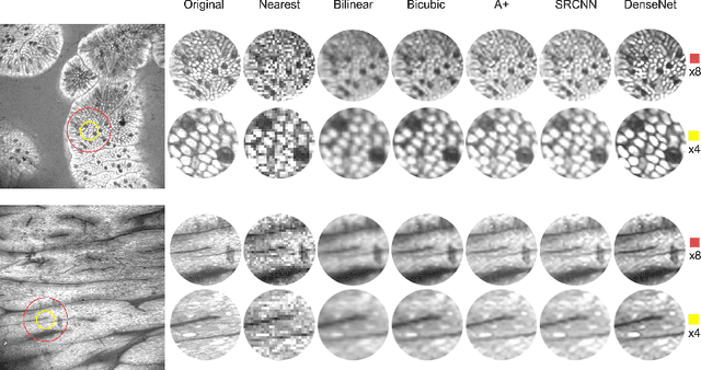 Figure 3 for Can Deep Learning Relax Endomicroscopy Hardware Miniaturization Requirements?
