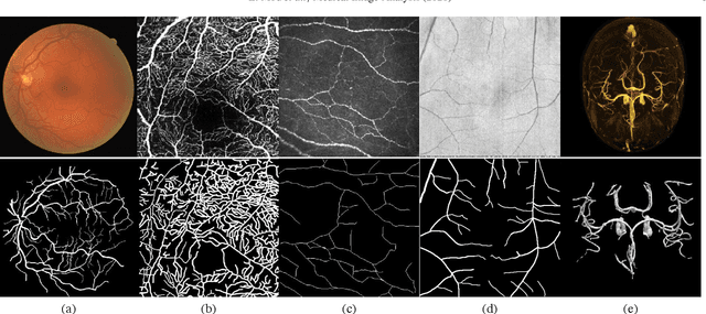 Figure 1 for CS2-Net: Deep Learning Segmentation of Curvilinear Structures in Medical Imaging