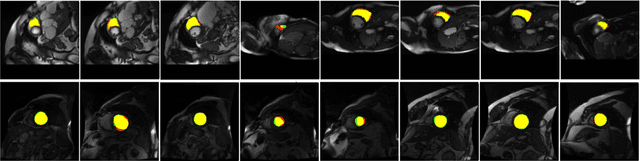 Figure 4 for U-Net Training with Instance-Layer Normalization