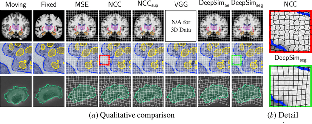 Figure 4 for Semantic similarity metrics for learned image registration