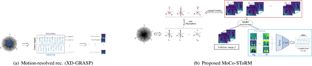 Figure 1 for Dynamic imaging using motion-compensated smoothness regularization on manifolds