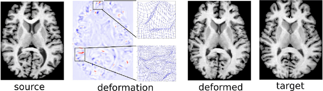 Figure 1 for FAIM -- A ConvNet Method for Unsupervised 3D Medical Image Registration