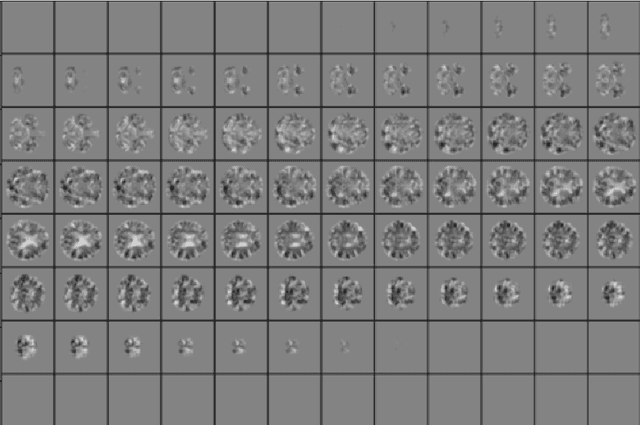 Figure 3 for BayesNetCNN: incorporating uncertainty in neural networks for image-based classification tasks