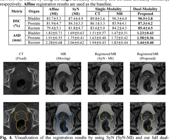 Figure 2 for Deep Learning based Inter-Modality Image Registration Supervised by Intra-Modality Similarity