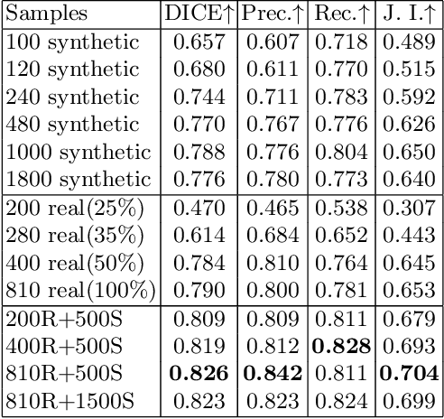 Figure 4 for METGAN: Generative Tumour Inpainting and Modality Synthesis in Light Sheet Microscopy