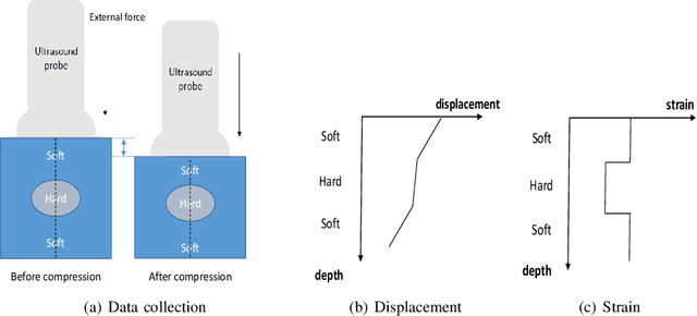 Figure 1 for Automatic Frame Selection using CNN in Ultrasound Elastography