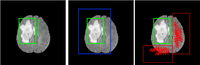 Figure 1 for A Multi-task Contextual Atrous Residual Network for Brain Tumor Detection & Segmentation