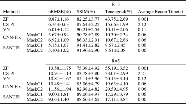 Figure 2 for SANTIS: Sampling-Augmented Neural neTwork with Incoherent Structure for MR image reconstruction