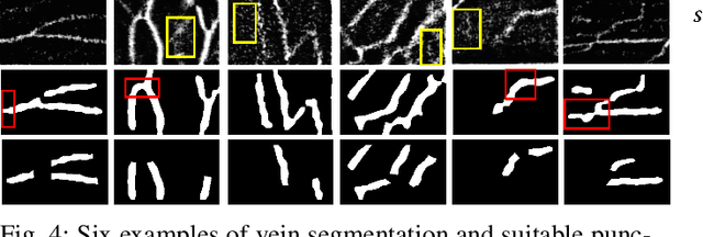 Figure 4 for VeniBot: Towards Autonomous Venipuncture with Automatic Puncture Area and Angle Regression from NIR Images