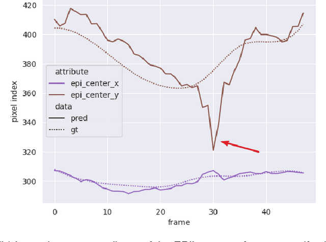 Figure 4 for Echocardiography Segmentation with Enforced Temporal Consistency