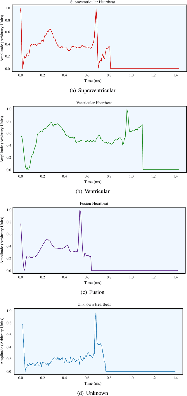 Figure 3 for MyWear: A Smart Wear for Continuous Body Vital Monitoring and Emergency Alert