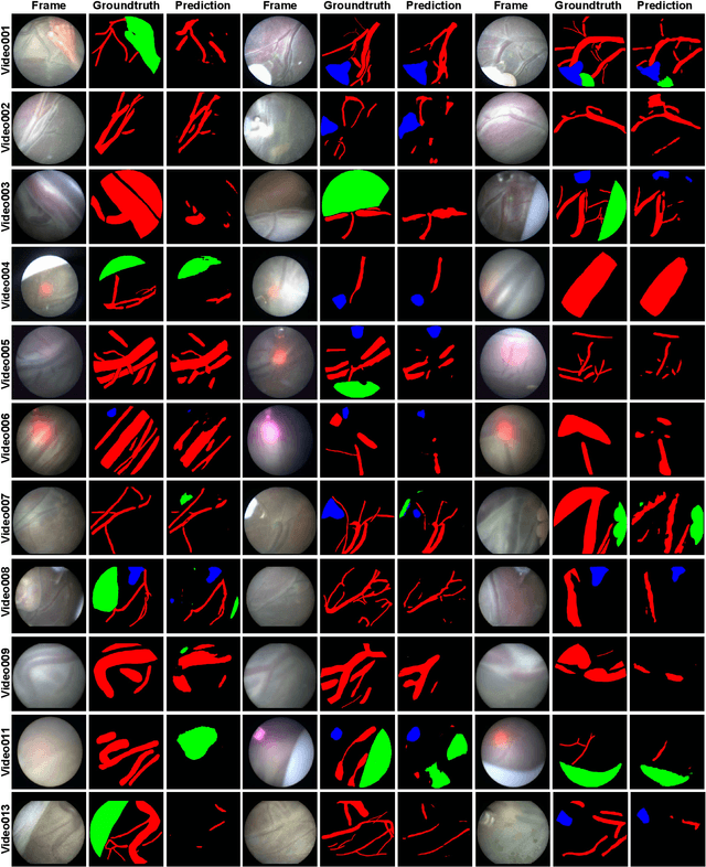 Figure 2 for FetReg: Placental Vessel Segmentation and Registration in Fetoscopy Challenge Dataset