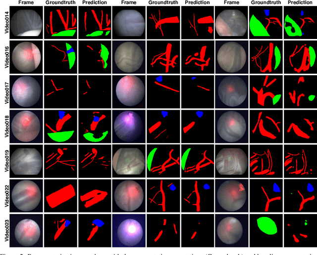 Figure 3 for FetReg: Placental Vessel Segmentation and Registration in Fetoscopy Challenge Dataset