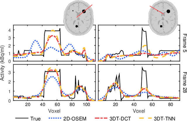 Figure 2 for Dynamic PET cardiac and parametric image reconstruction: a fixed-point proximity gradient approach using patch-based DCT and tensor SVD regularization
