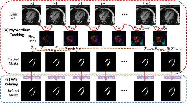 Figure 4 for Anatomy-Aware Cardiac Motion Estimation