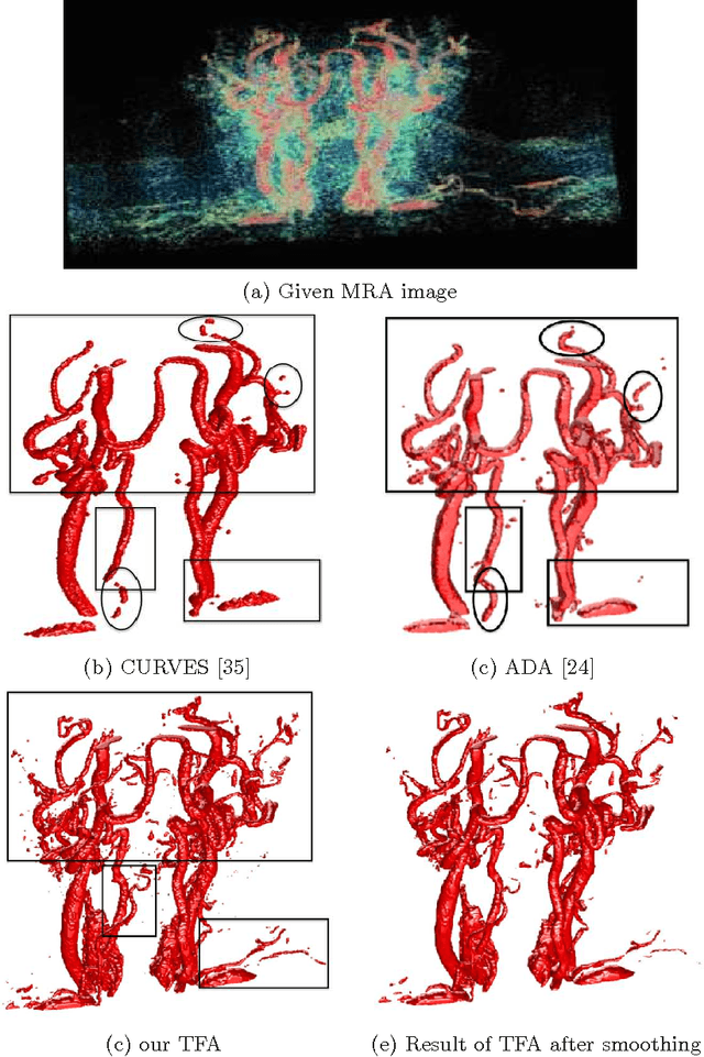 Figure 4 for Vessel Segmentation in Medical Imaging Using a Tight-Frame Based Algorithm