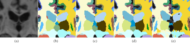 Figure 3 for Towards integrating spatial localization in convolutional neural networks for brain image segmentation