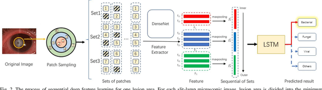 Figure 2 for Deep Sequential Feature Learning in Clinical Image Classification of Infectious Keratitis