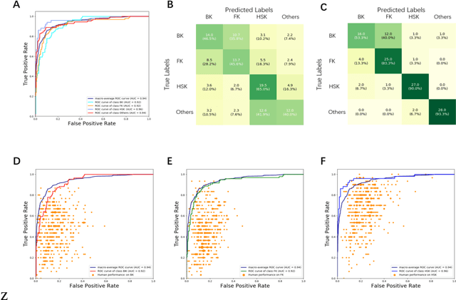 Figure 4 for Deep Sequential Feature Learning in Clinical Image Classification of Infectious Keratitis