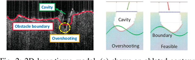 Figure 2 for Robotic Laser Orientation Planning with a 3D Data-driven Method