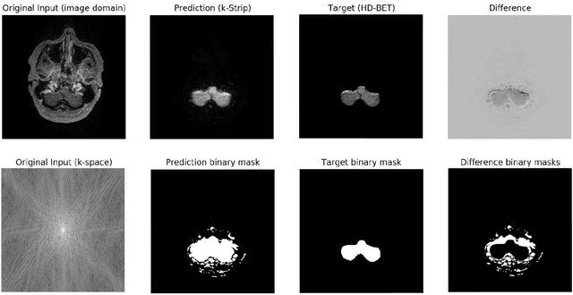 Figure 4 for k-strip: A novel segmentation algorithm in k-space for the application of skull stripping