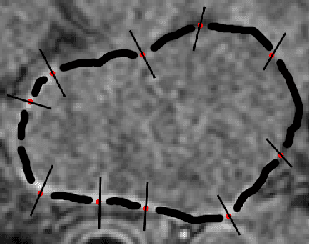 Figure 3 for Mixture Modeling of Global Shape Priors and Autoencoding Local Intensity Priors for Left Atrium Segmentation