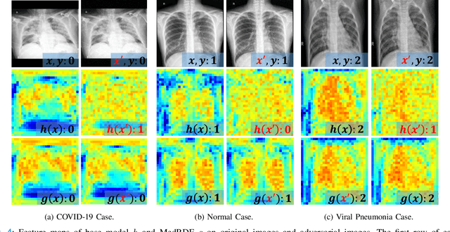 Figure 4 for MedRDF: A Robust and Retrain-Less Diagnostic Framework for Medical Pretrained Models Against Adversarial Attack