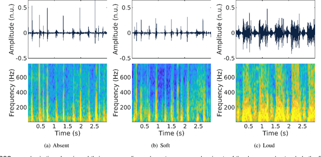 Figure 1 for Beyond Heart Murmur Detection: Automatic Murmur Grading from Phonocardiogram