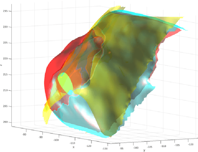 Figure 3 for Multi-scale Image Fusion Between Pre-operative Clinical CT and X-ray Microtomography of Lung Pathology