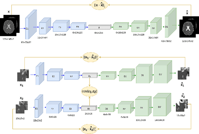 Figure 1 for Patch vs. Global Image-Based Unsupervised Anomaly Detection in MR Brain Scans of Early Parkinsonian Patients